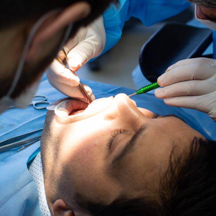 Tooth extraction